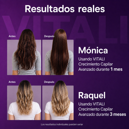 Vitali™ - Vitaminas 24 en 1 para el cabello